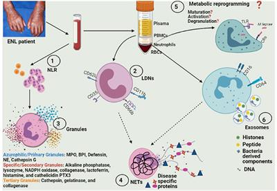 Neutrophil NETworking in ENL: Potential as a Putative Biomarker: Future Insights